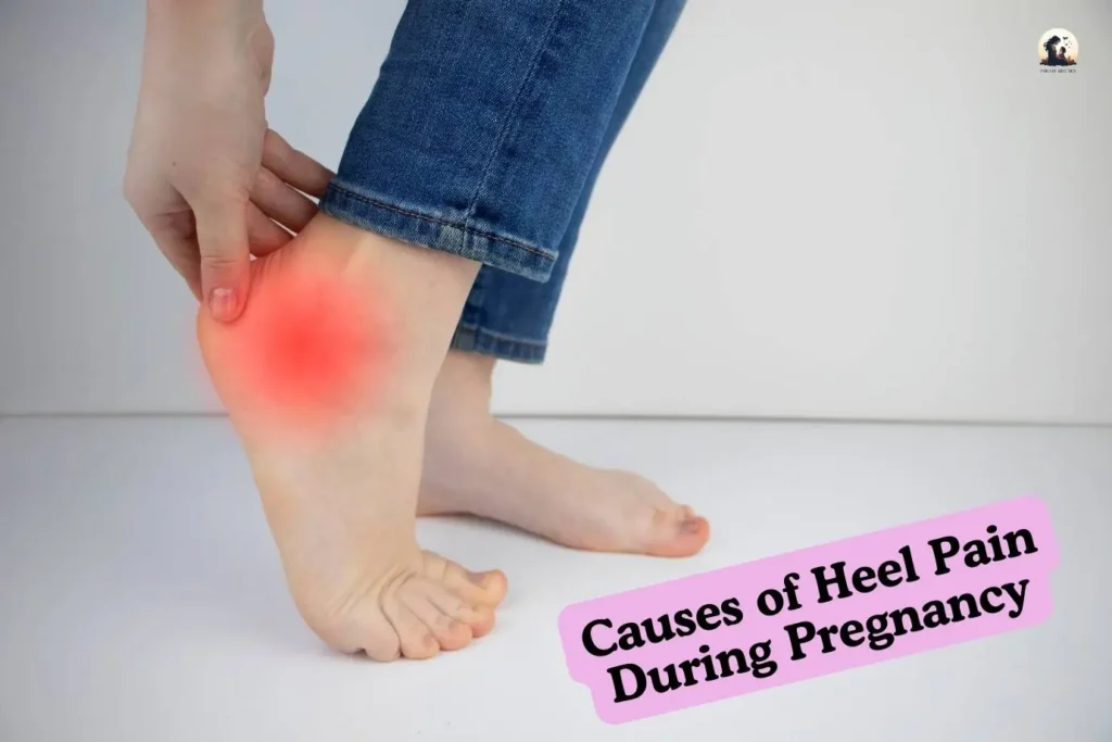 Causes of Heel Pain During Pregnancy