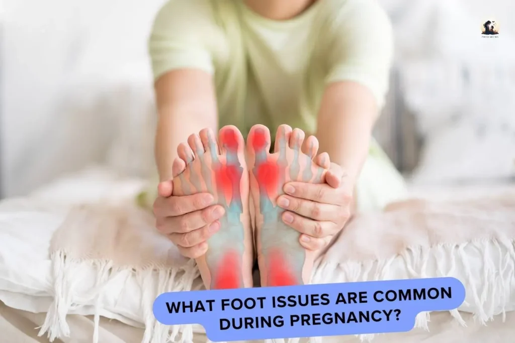 What foot issues are common during pregnancy